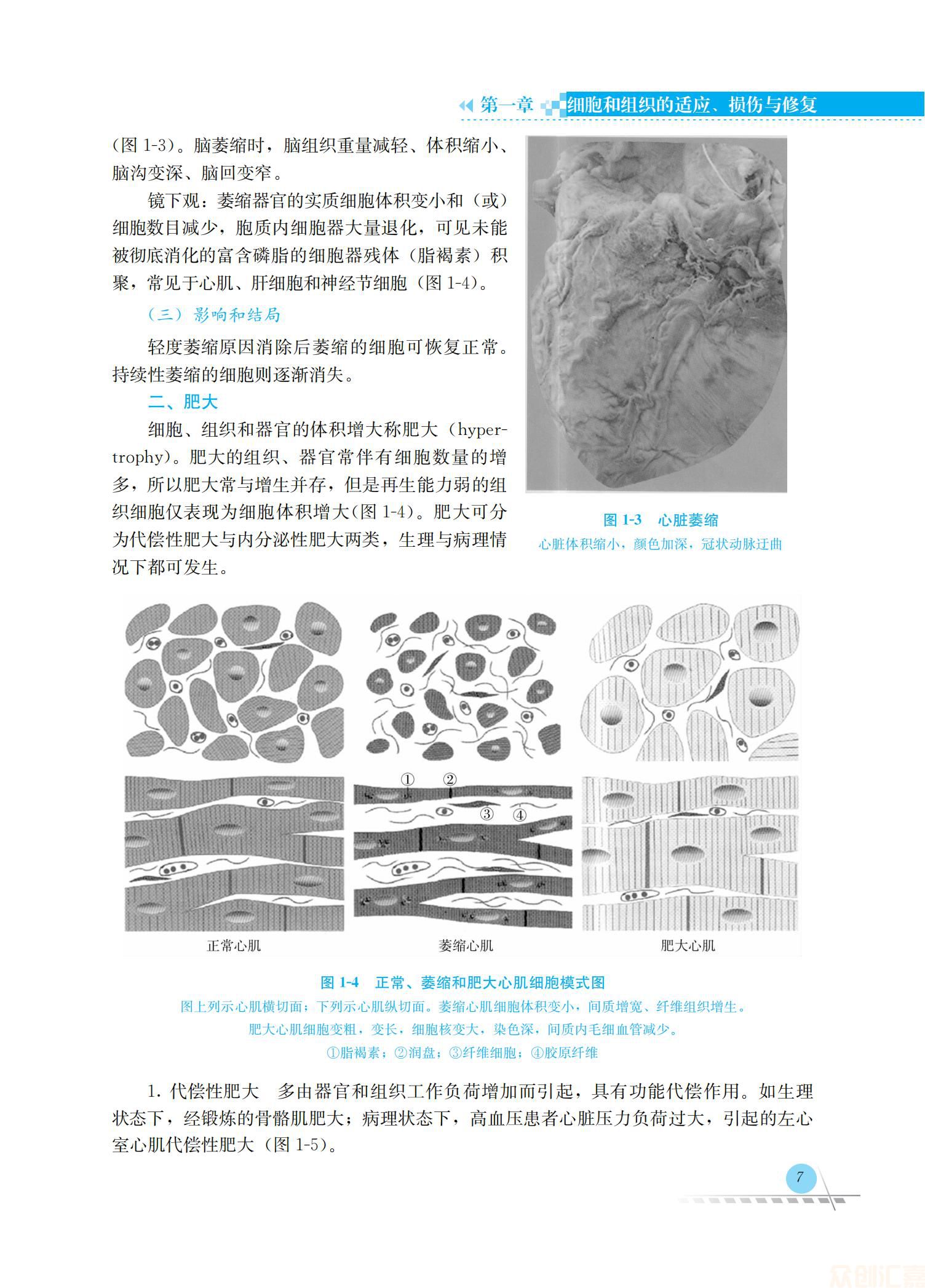 病理学36.00_14.jpg